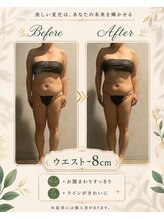 リンガ(Ringa)/ウエスト－8cmの変化