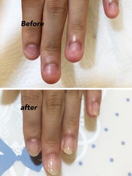 モアニヒロオ 広尾駅前店(MOANI Hiroo)/【深爪育成】