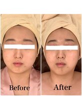 スペチアーレ 夙川/痩せた？と周りから聞かれる変化