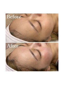 ホワイトワックス 京都四条烏丸(WHITE WAX)/1度やると病みつき◎