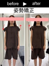 エレヴィザ トウキョウ 恵比寿院(ELVISA TOKYO)/肩の左右差改善　/　骨盤矯正