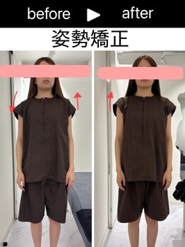 エレヴィザ トウキョウ 恵比寿院(ELVISA TOKYO)/肩の左右差改善 / 骨盤矯正