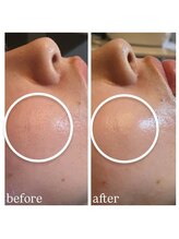 リエイト(Re:eight)/プラズマ＋ハイドラ