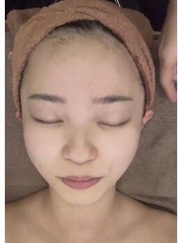 リラクゼーションサロン ラキ(laki)/ハーブピーリング/ピーリング