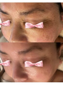 美温(mion)/年齢の出る目元のケア