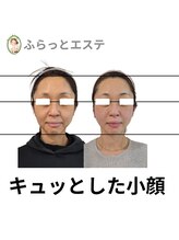 ふらっとエステ/顔が小さくてもコルギが必要