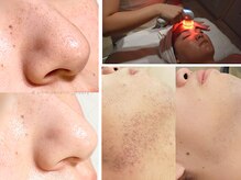 ディバティ(DIVATY)の雰囲気(毛穴~シワたるみ改善エステやキッズから女性男性利用できる脱毛)