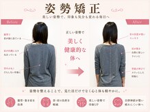 練馬アカデミア美容整体院/ストロングポイントの姿勢矯正　