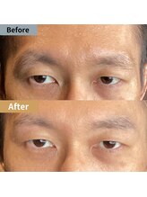 眉毛ハウス 吉祥寺店(眉毛HOUSE)/お客様の施術例(吉祥寺/東京)