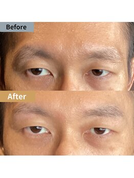 眉毛ハウス 吉祥寺店(眉毛HOUSE)/お客様の施術例(吉祥寺/東京)