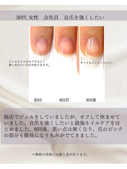 最強ネイルケア