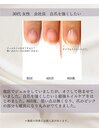 最強ネイルケア