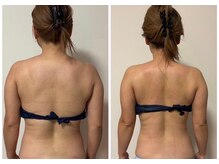 ルナグランデ 心斎橋店(Luna grande.)/背中美人