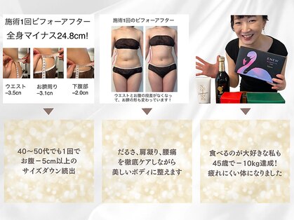 リベラ(LIBERA)の写真