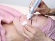 ジュエルビューティー(Jewel Beauty)の写真/憧れの韓国ツルスベ肌に♪毛穴の汚れを徹底除去！毛穴の開き、ザラつき、黒ずみでお悩みの方におすすめ◎