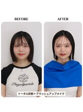 シュアリー(Surely)/トータルコースお客様