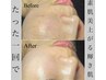 【ご新規様限定】ハーブピーリングで調子が悪いお肌を立て直す!!¥8,000