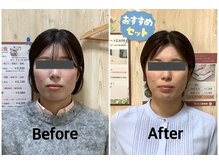 まごころ整骨院の雰囲気（電気美容鍼＋小顔矯正before＆after(ワンクール施術)）