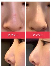 リレア(RELAIR)/美容矯正