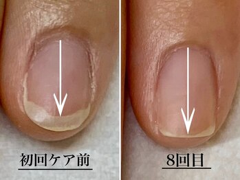 ネイルルーム エンヌ(nail room en'ne)
