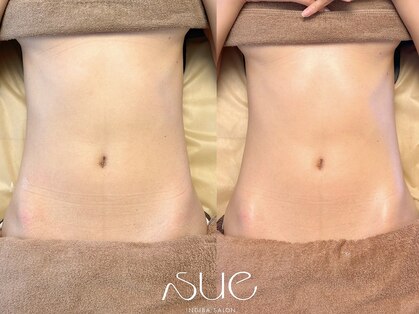 スー(Sue)の写真