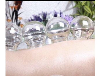 カコウドウ/吸玉療法 カッピング