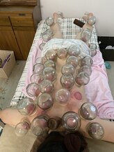 東洋経絡エステ アンド リラクゼーション/全身カッピング、スライド可能◎