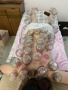 東洋経絡エステ アンド リラクゼーション/全身カッピング、スライド可能◎