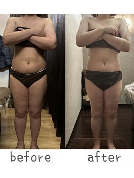 トモズサロン28(Tomos.salon.)/老廃物排出の促進により疲労回復