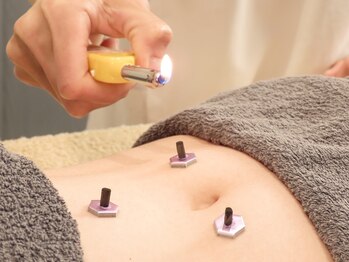 オリエントエクスプレス/妊活の方にはお灸