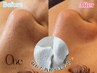 【8.9月限定価格★】フェイシャルWax(額+小鼻+口周り+両頬+顎)高濃度パック付
