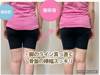 骨盤整体 サクラ(Sakura)/ビフォーアフター/産後骨盤矯正
