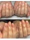 mion nailの写真/【爪の形や弱さに悩む方必見!】技術力に定評あり◎自爪育成×美フォルム仕上げで、自信の持てる指先へ♪