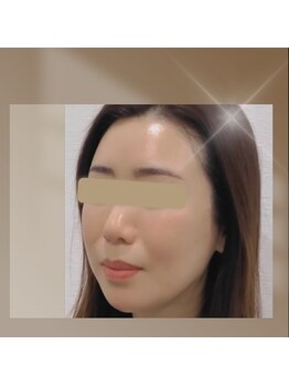 ククルヘルスビューティー(CUCURU health×beauty)の写真/肌を育てるプラピール&美容成分UPハーブピーリング★話題の最新美容で憧れの透明感溢れる水光肌に◎