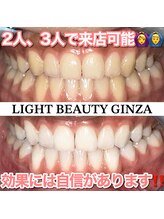 ライトビューティー 銀座店(LightBeauty)/東銀座/ホワイトニング/症例写真