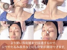 ミエル 日吉店(miel)/6.ピーリング剤２ 