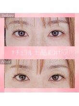 コトリ(kotori)/デザインキープラッシュ