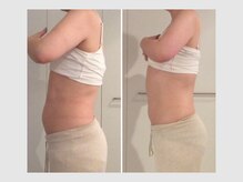 カロン 銀座(Kalon)/【腸もみ90分】20回結果！