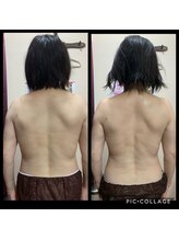 リレア(RELAIR)/美容矯正