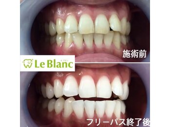 ルブラン 奈良店(Le Blanc)/本当におすすめの