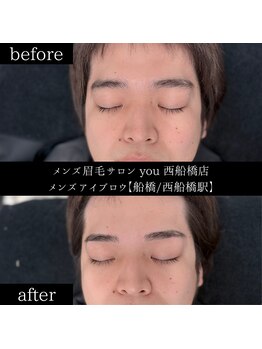 ユー 西船橋店(you)/ビフォーアフターお写真