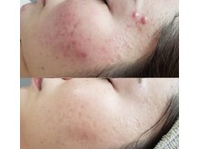 プシュケ(Psyche)の雰囲気(フォトギャラリー、サロンInstagramにてbeforeafter掲載中♪)