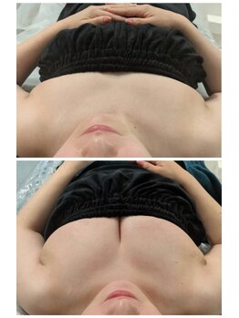 エムプリュ 心斎橋店(M.plus)/美乳コース