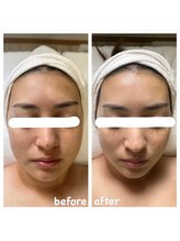 エナッシュビューティサロン(ENASH)/