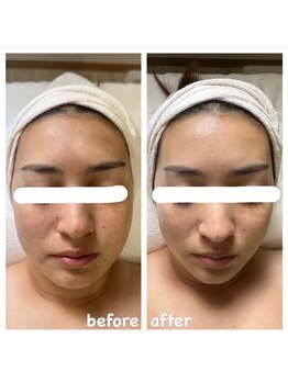 エナッシュビューティサロン(ENASH)/