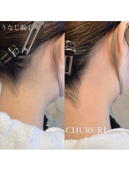 チュルリ 新町店(Chururi)/うなじ/うなじワックス脱毛/脱毛