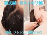 【頭皮鍼＋首スッキリ鍼】頭痛、ストレス、睡眠の質アップ　45分