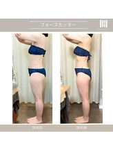 カリスボーテ 関本店/フォースカッター