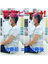 藤接骨院 焼津小川院/猫背矯正で背筋ピーン