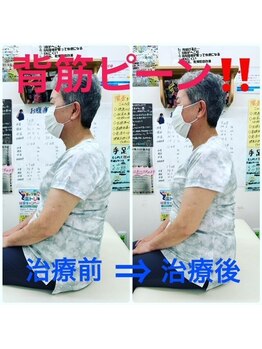 藤接骨院 焼津小川院/猫背矯正で背筋ピーン